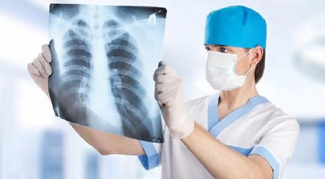 Кіровоградщина – у першій трійці областей щодо рівня захворювання на туберкульоз